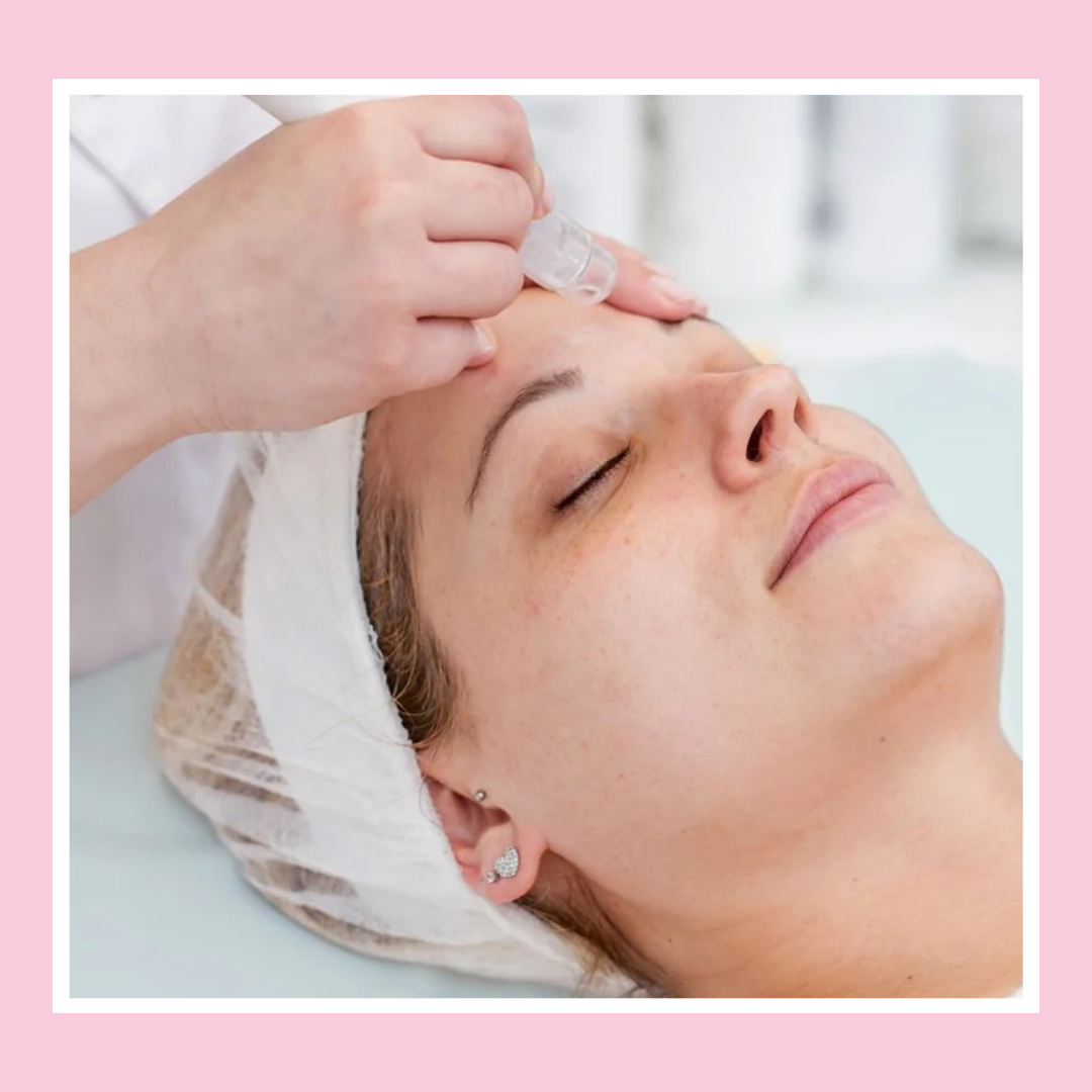 Microdermabrasion in London Skin Exfoliation and Rejuvenation