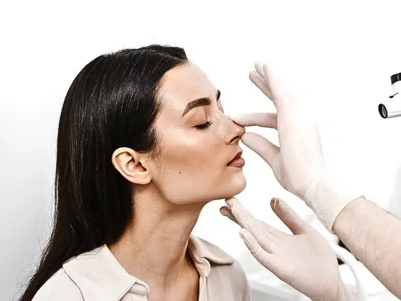 non surgical rhinoplasty patient