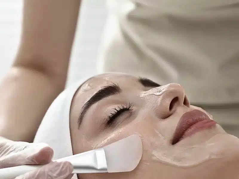 chemical peels treatments