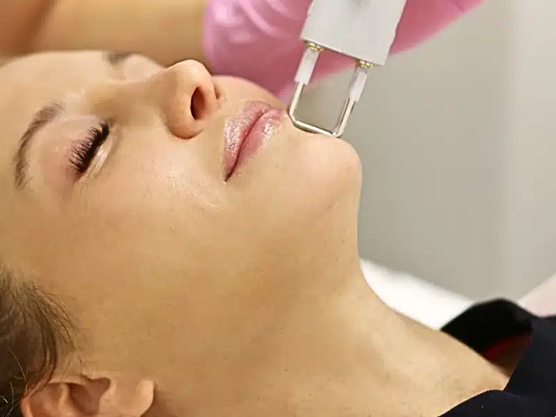 fraxel laser treatments
